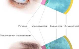 Как выглядит глаз при синдроме сухого глаза