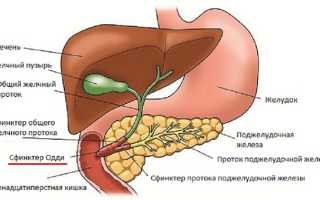 Хирургическое лечение при постхолецистэктомическом синдроме