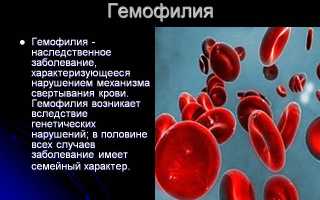 Гемофилия код по мкб 10 у взрослых