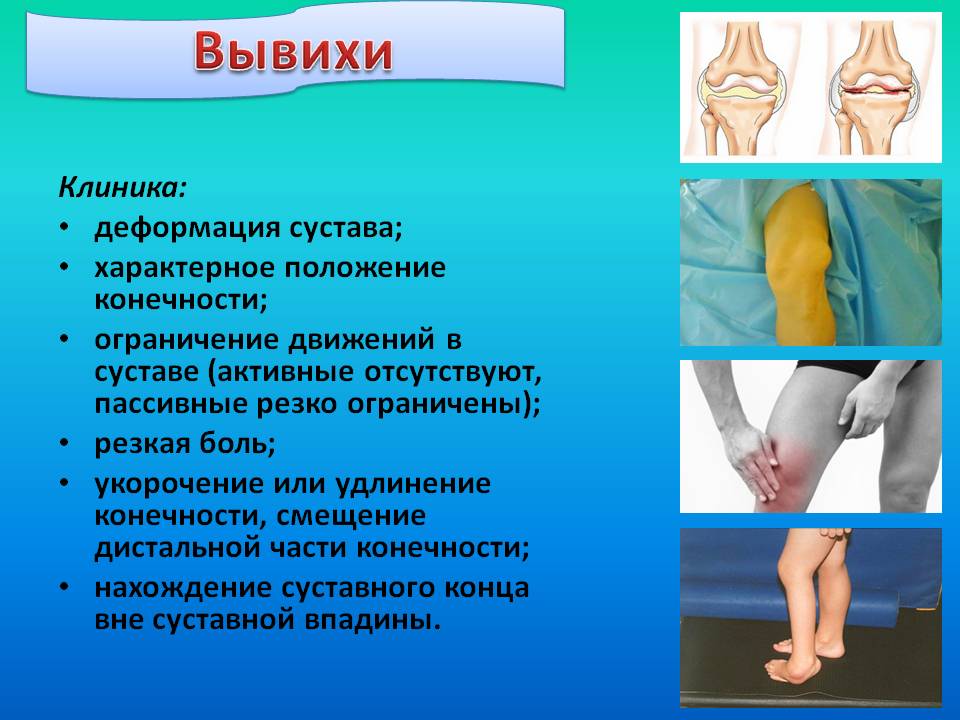 Код мкб вывих коленного сустава