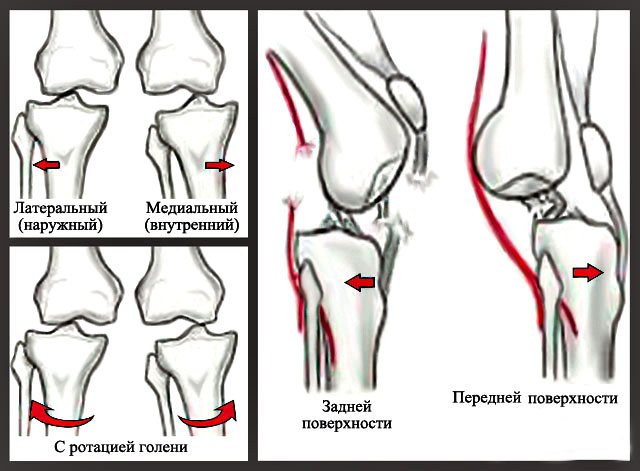Код мкб вывих коленного сустава