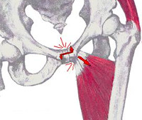 ARS синдром ARS синдром