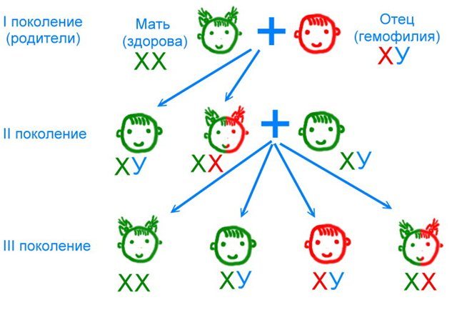 Генетические аспекты заболеваемости гемофилией