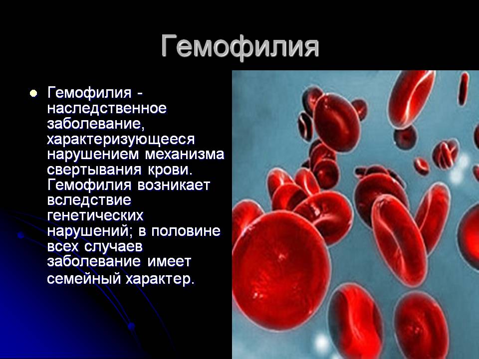 Гемофилия