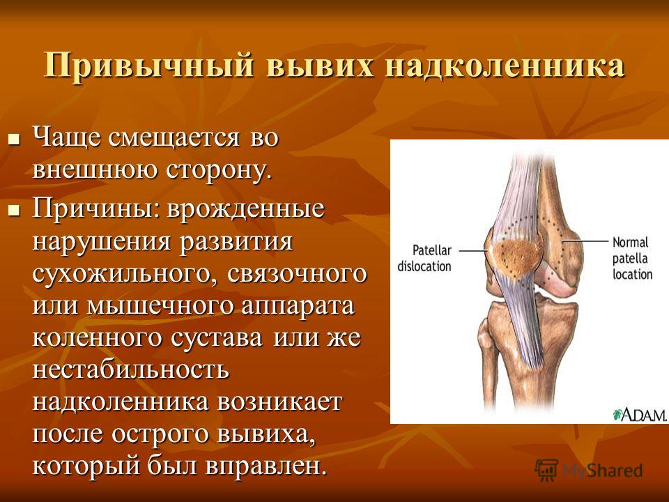 Код мкб вывих коленного сустава