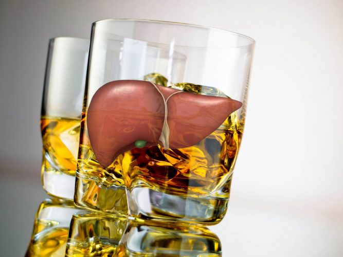 Алкогольный гепатит