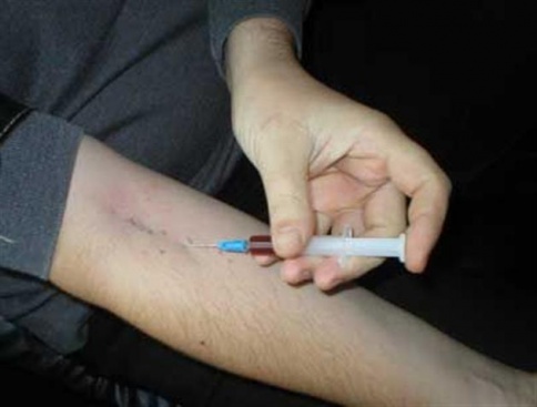 наркоманы наиболее подвержены гепатиту