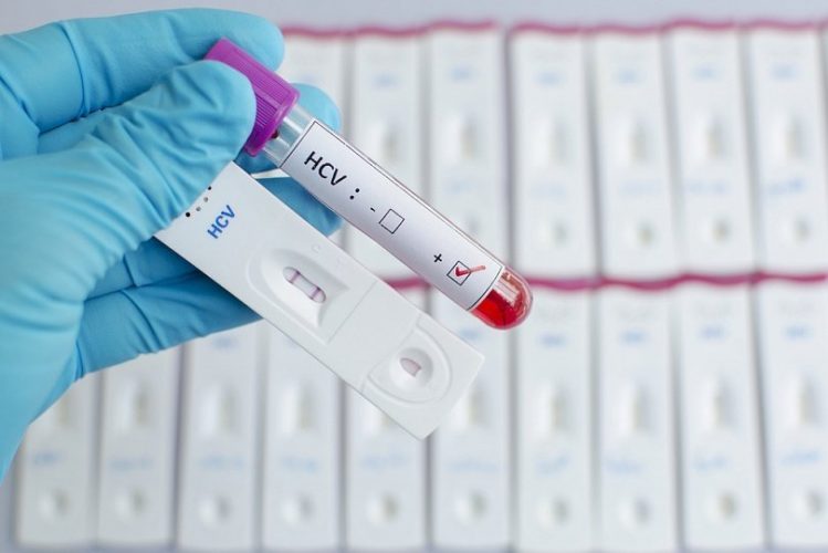 Биохимический анализ крови