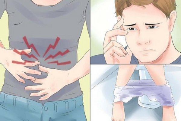 Основные признаки острого панкреатита