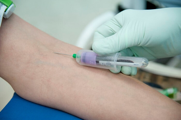 Кровь из вены