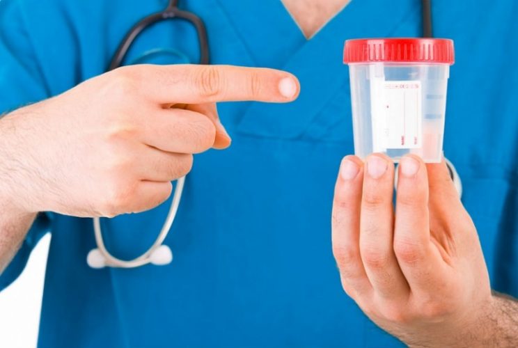 общий анализ кала