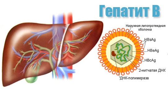 гепатите В