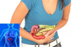 обструктивный панкреатит