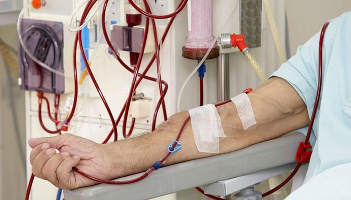 Protsedura gemodializa