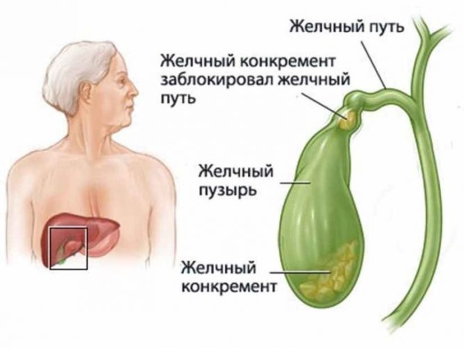 Желчный пузырь
