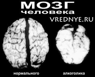 Алкоголизм и его последствия Алкоголизм и его последствия