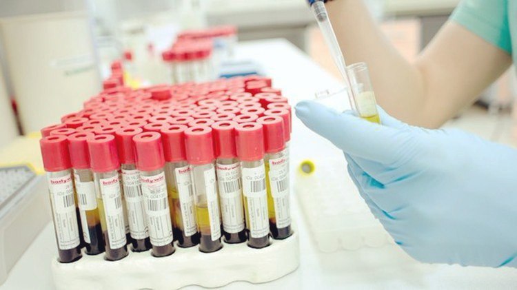 Анализ крови на биохимию