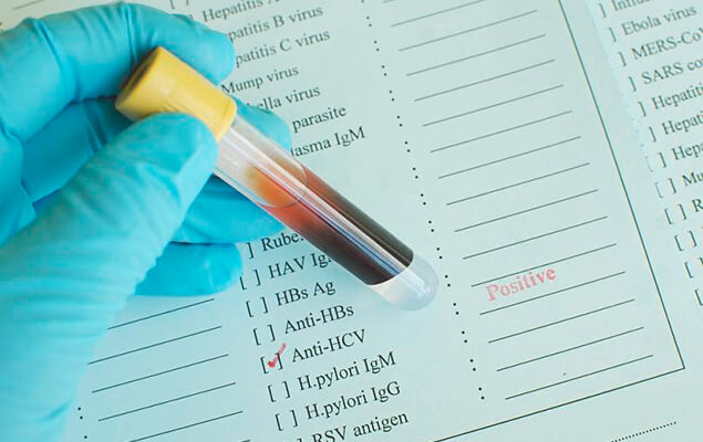 анализ крови на гепатит