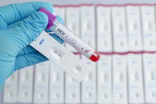 анализ крови на гепатит