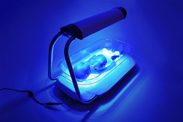 фототерапия новорожденных