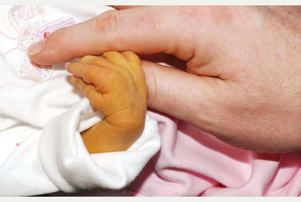 желтуха у новорожденных