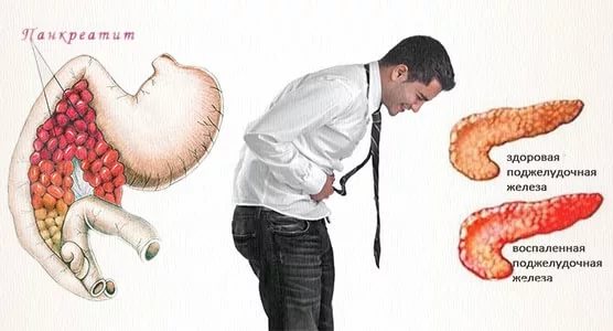 Панкреатит