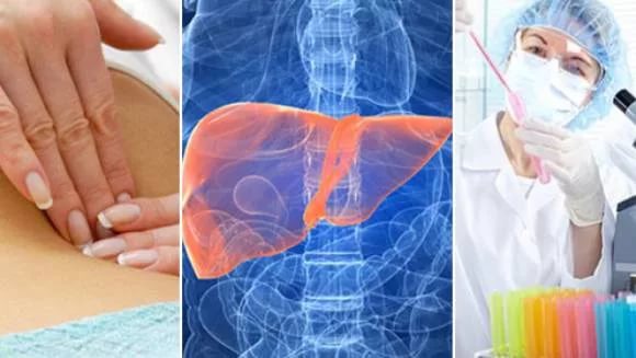 Осмотр при гепатите