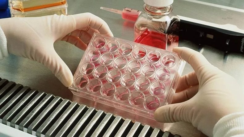 Анализы при циррозе