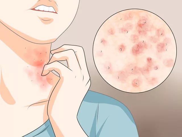 возможны аллергические реакции