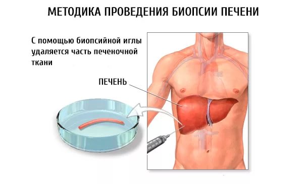 Биопсия тканей печени