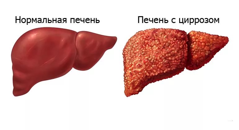Печень