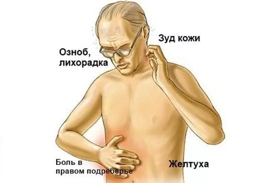 Основные симптомы заболевания