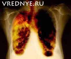 Как очистить легкие от никотина Как очистить легкие от никотина