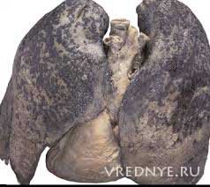 легкие после курения легкие после курения