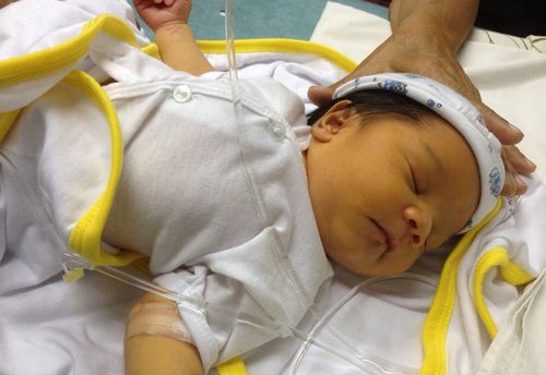 желтуха у новорожденных