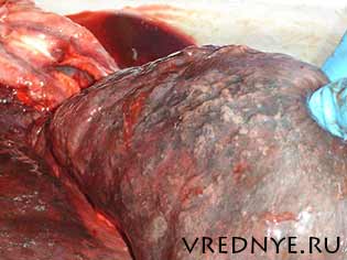 влияние алкоголя на печень