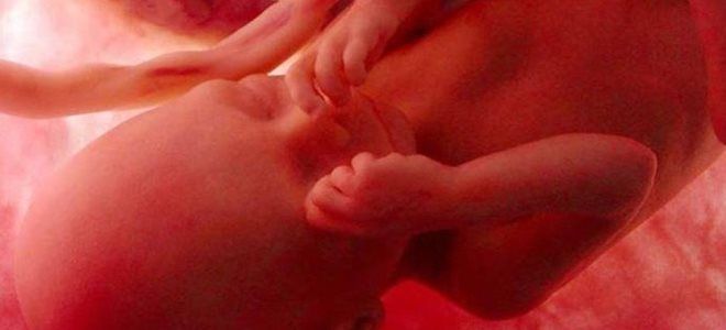 29 недель 29 недель