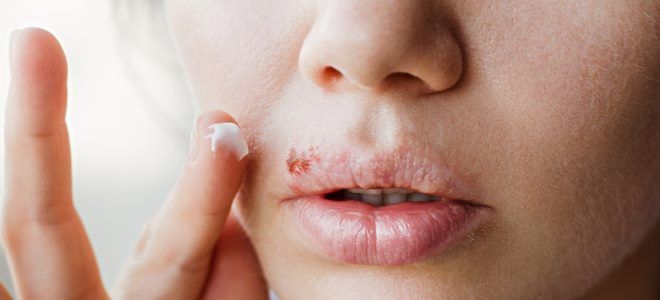 фото1 ацикловир мазь состав