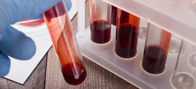 что такое хгч что такое хгч