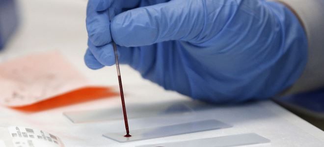 эритроциты у детей эритроциты у детей