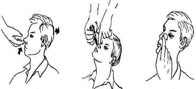 эваменол состав эваменол состав