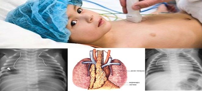 где тимус где тимус