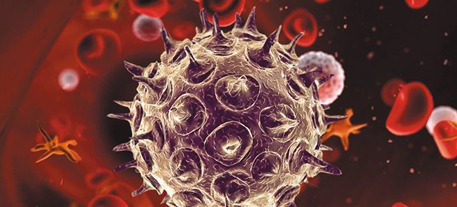 герпес зостер герпес зостер