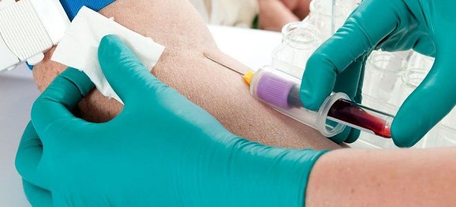 как снизить холестерин в крови как снизить холестерин в крови