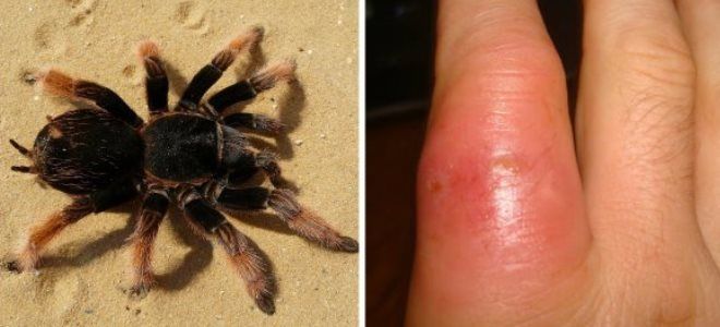 как выглядит укус тарантула как выглядит укус тарантула