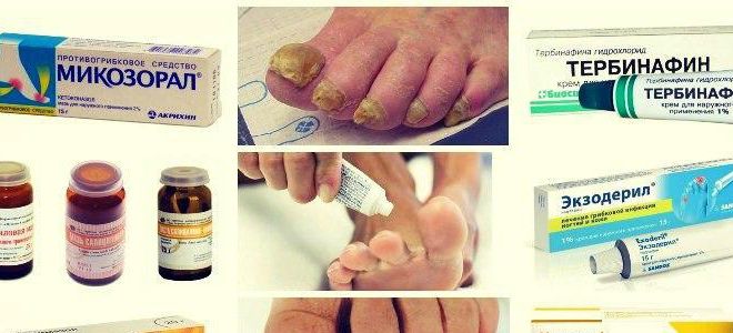 классификация противогрибковых препаратов классификация противогрибковых препаратов