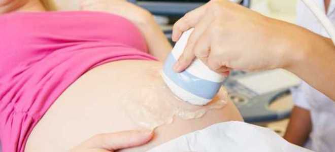 когда делают первый скрининг когда делают первый скрининг