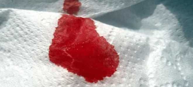 кровь после запора кровь после запора