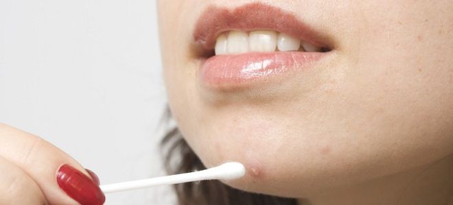 Левомеколь от гнойных прыщей Левомеколь от гнойных прыщей