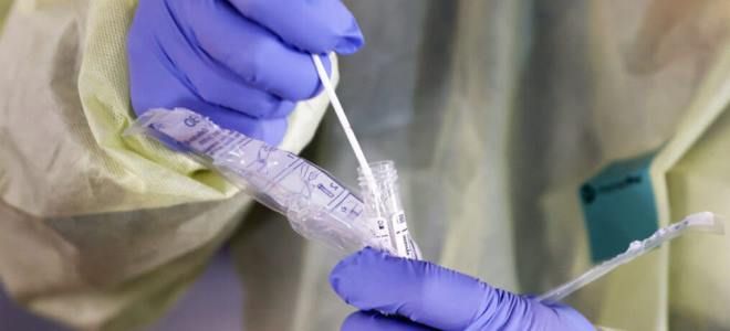 мазок на коронавирус у человека мазок на коронавирус у человека